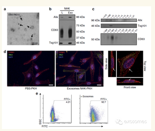 图一a,nhk(人皮肤正常角质细胞)转入cd63-gfp(外泌体标志,3天后,免疫