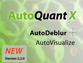高级图像反卷积、3D展示软件平台AutoQuant