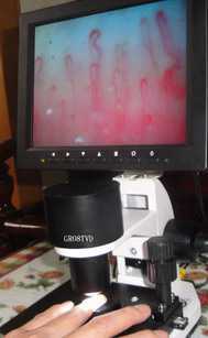 青岛烟台威海上海GR008TVD血流显微镜