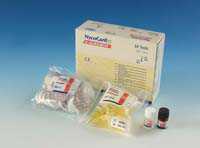 尿微量蛋白检测试剂盒