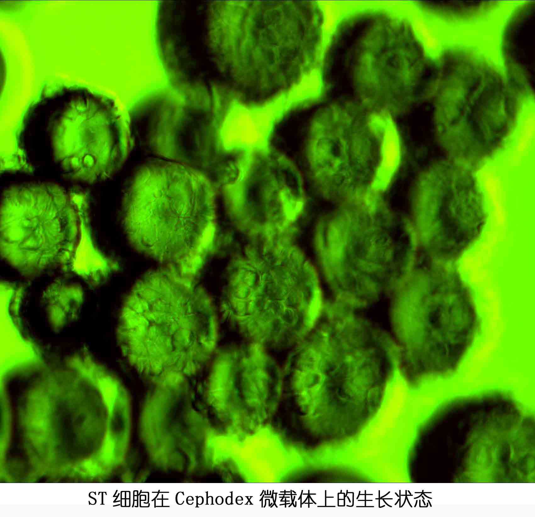 ST细胞在Cephodex微载体上的生长状态图