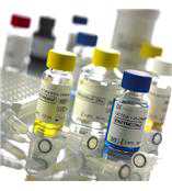 流感B IgM(Influenza B IgM)ELISA试剂盒