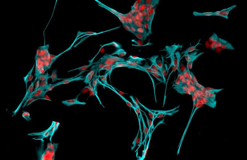 大鼠海马趾星形胶质细胞