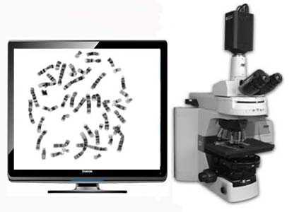 染色体核型分析系统