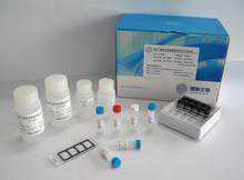 大鼠水通道蛋白0(AQP-0)ELISA试剂盒