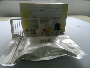 强直性脊柱炎B27检测试剂盒