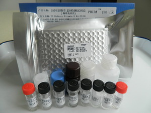 25羟基维生素D检测试剂盒（酶联免疫法）