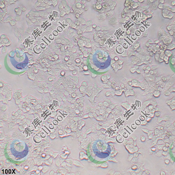 T47D人乳腺导管癌细胞