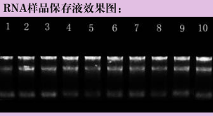 RNA 样品保存液