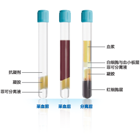 单个核细胞准备管