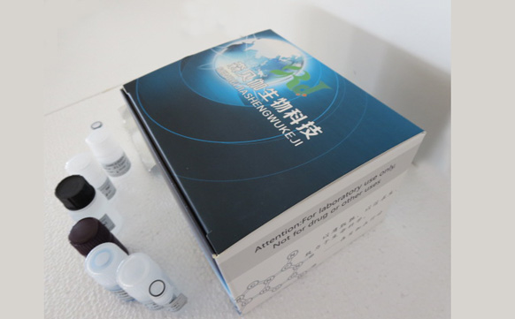 人流行性出血热IgG抗体(EHF IgG)ELISA试剂盒