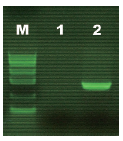 甲基化专一性PCR试剂盒