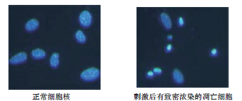 荧光染色细胞凋亡检测试剂盒