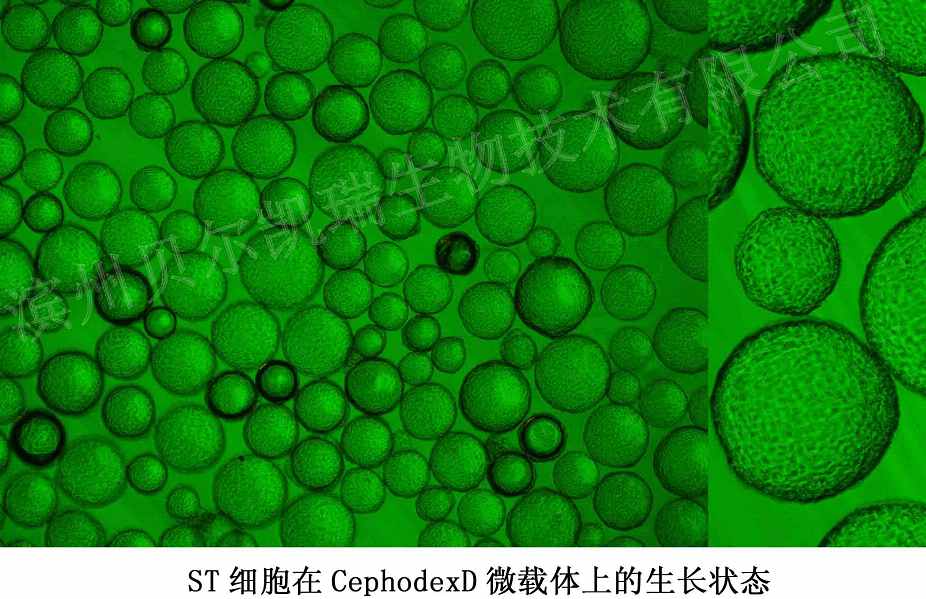 ST细胞在CephodexD型微载体上的生长状态