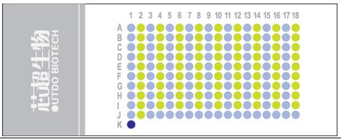 生存期胃腺癌180点HStmA180Su 添加p53和ki67和CD133和ECadherin和VEGFR15