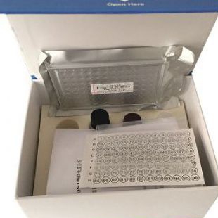 人免疫球蛋白A(IgA)ELISA试剂盒