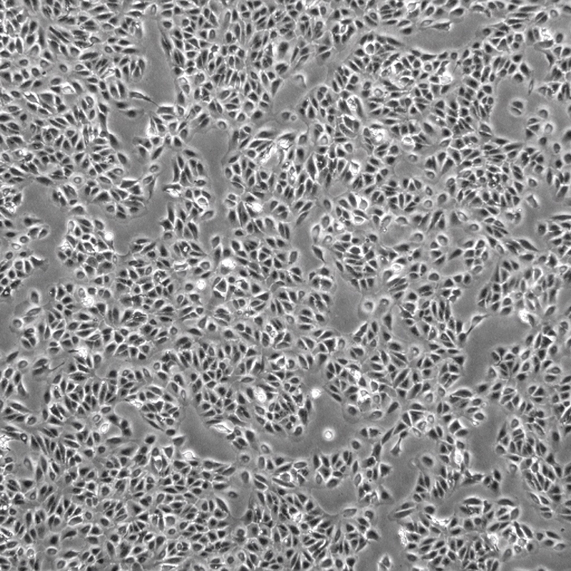 人视网膜色素上皮细胞（ARPE-19）