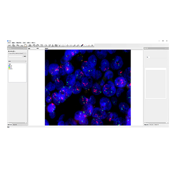 MFISH荧光原位杂交分析系统
