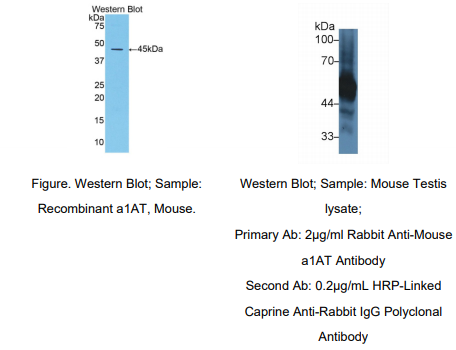 小鼠α1-抗胰蛋白酶(a1AT)多克隆抗体