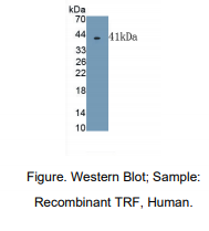 人转铁蛋白(TF)多克隆抗体