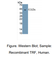 https://msimg.bioon.com/bionline/goods-no-pic.png