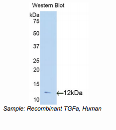 https://msimg.bioon.com/bionline/goods-no-pic.png