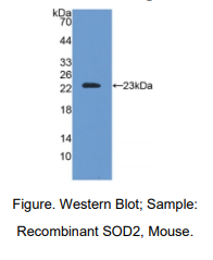 小鼠线粒体超氧化物歧化酶(SOD2)多克隆抗体