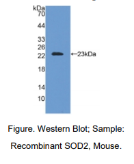 https://msimg.bioon.com/bionline/goods-no-pic.png