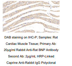 大鼠脑钠素(BNP)多克隆抗体