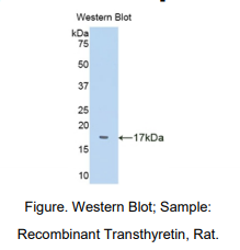 https://msimg.bioon.com/bionline/goods-no-pic.png