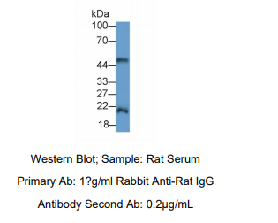 https://msimg.bioon.com/bionline/goods-no-pic.png