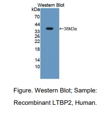 https://msimg.bioon.com/bionline/goods-no-pic.png