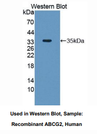 https://msimg.bioon.com/bionline/goods-no-pic.png