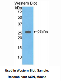 小鼠Axis抑制蛋白(AXIN)多克隆抗体