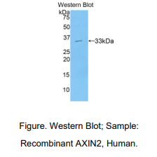 人Axis抑制蛋白2(AXIN2)多克隆抗体