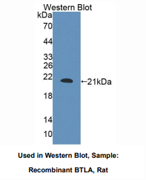 大鼠B/T-淋巴细胞衰减因子(BTLA)多克隆抗体