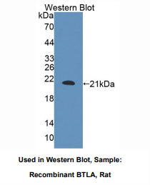 https://msimg.bioon.com/bionline/goods-no-pic.png