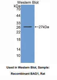 https://msimg.bioon.com/bionline/goods-no-pic.png