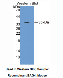 https://msimg.bioon.com/bionline/goods-no-pic.png