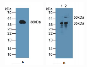 https://msimg.bioon.com/bionline/goods-no-pic.png