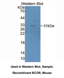 https://msimg.bioon.com/bionline/goods-no-pic.png