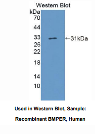 https://msimg.bioon.com/bionline/goods-no-pic.png