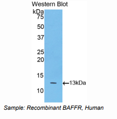 人B-细胞激活因子受体(BAFFR)多克隆抗体