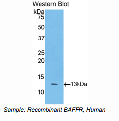 https://msimg.bioon.com/bionline/goods-no-pic.png