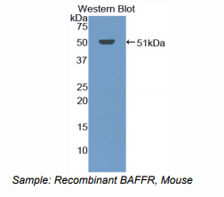 https://msimg.bioon.com/bionline/goods-no-pic.png