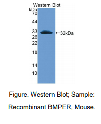 https://msimg.bioon.com/bionline/goods-no-pic.png