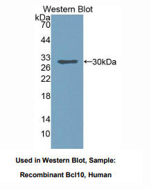 人B-细胞淋巴瘤因子10(Bcl10)多克隆抗体