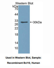 https://msimg.bioon.com/bionline/goods-no-pic.png