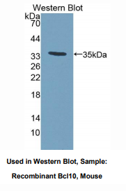 小鼠B-细胞淋巴瘤因子10(Bcl10)多克隆抗体