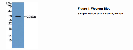 人B-细胞淋巴瘤因子11A(Bcl11A)多克隆抗体